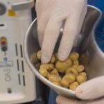 Médico de Ituiutaba viraliza ao mostrar pedras nos rins retiradas de paciente que bebia até 3 litros de refrigerante por dia